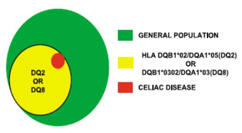 Importanza della Genetica La quasi totalità dei celiaci è HLA-DQ2 o DQ8 La negatività