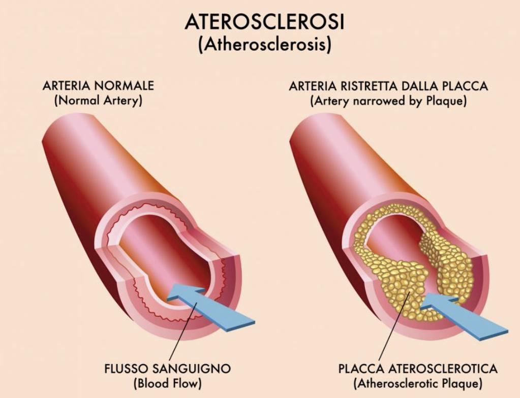 Figura 15. Alla nascita, i vasi sanguigni sono flessibili ed elastici e il sangue può scorrervi facilmente.