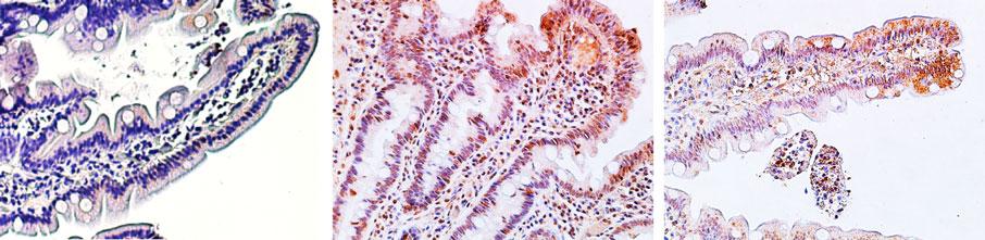 EFFETTI Infiammatori-tossici 31-43 dell α-gliadina in grado di indurre danni tissutali alla mucosa intestinale Il peptide 31-43 induce le cellule epiteliali intestinali o della lamina propria ad