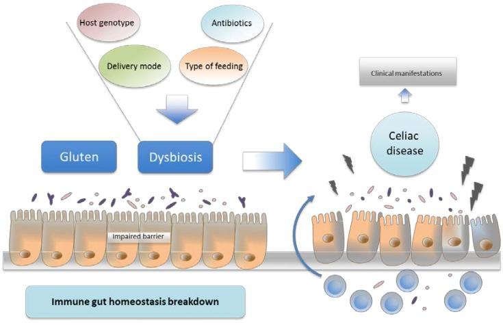 Disbiosi intestinale come possibile concausa della celiachia La disbiosi intestinale è una condizione dovuta ad un disequilibrio qualitativo e quantitativo della flora batterica enterica e può