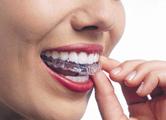 APPARECCHIO INVISIBILE (INVISALIGN ) L innovativa metodica ortodontica Invisalign permette di ottenere un sorriso bello e sano senza dover ricorrere agli antiestetici apparecchi tradizionali.
