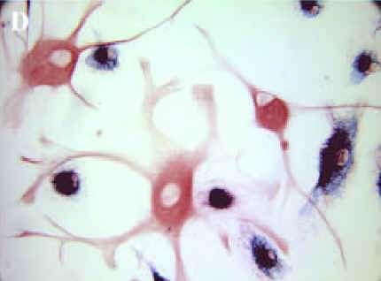 MICROGLIA Le cellule della