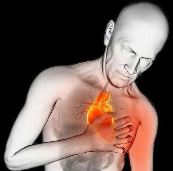 ANGINA PECTORIS L angina pectoris è una sofferenza del muscolo cardiaco, che si