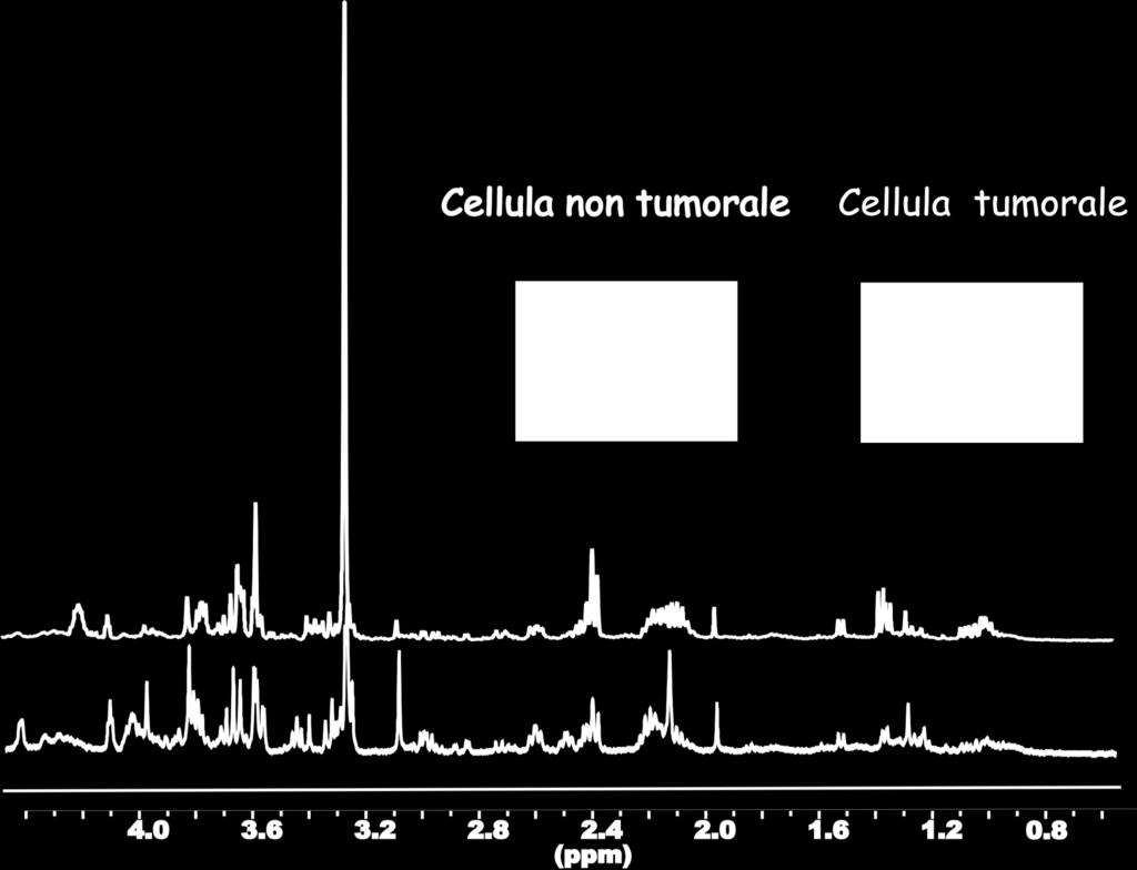 Spettroscopia di risonanza magnetica in vitro Le cellule tumorali hanno un