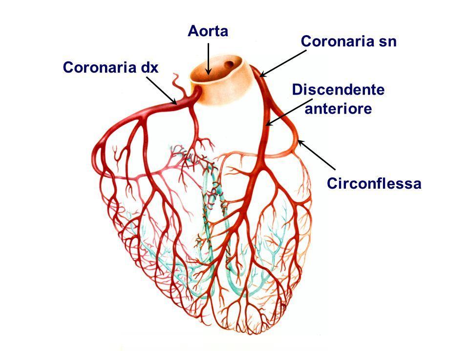 Ischemia cardiaca Cardiopatia ischemica: riduzione di apporto di sangue per occlusione di una coronaria Diverse possibili manifestazioni cliniche in funzione del