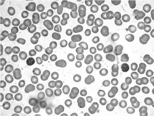 Elementi corpuscolati del sangue Scarsi effetti su emoglobina ed eritrociti Riduzione di linfociti, eosinofili, basofili e monociti entro 4-6 ore dalla somministrazione di una dose di