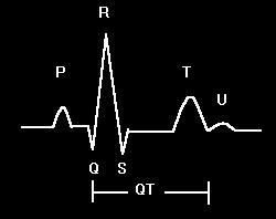 L attivazione inizia dal nodo SA (seno-atriale) che genera un impulso, il quale si diffonde dando origine all onda P. Questo raggiunge il nodo atrio ventricolare e l onda P finisce.