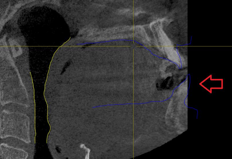 3 INDICAZIONI PER LE SCANSIONI 3 INDICAZIONI PER LE SCANSIONI Radiografia 3D Assicurarsi che tutte le informazioni