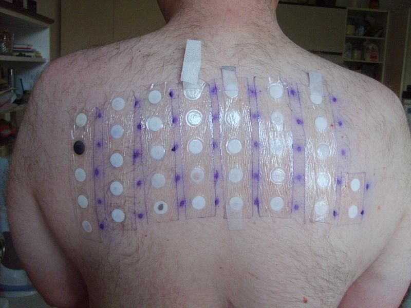 Permette di evidenziare reazioni di ipersensibilità di IV tipo.