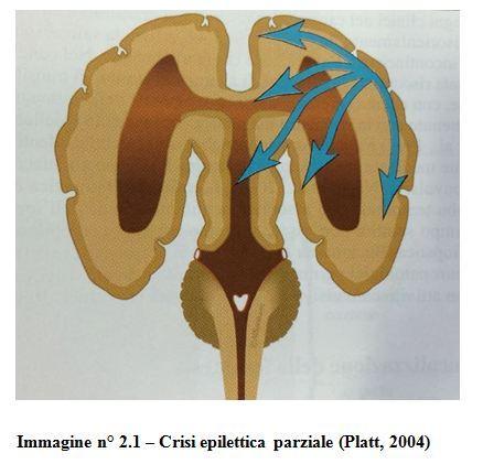 22 2.2.2 Classificazione clinica Le crisi epilettiche vengono classificate in base alle manifestazioni cliniche in: Crisi parziali (o focali) Crisi generalizzate (Podell, 2004) Ed in base alla