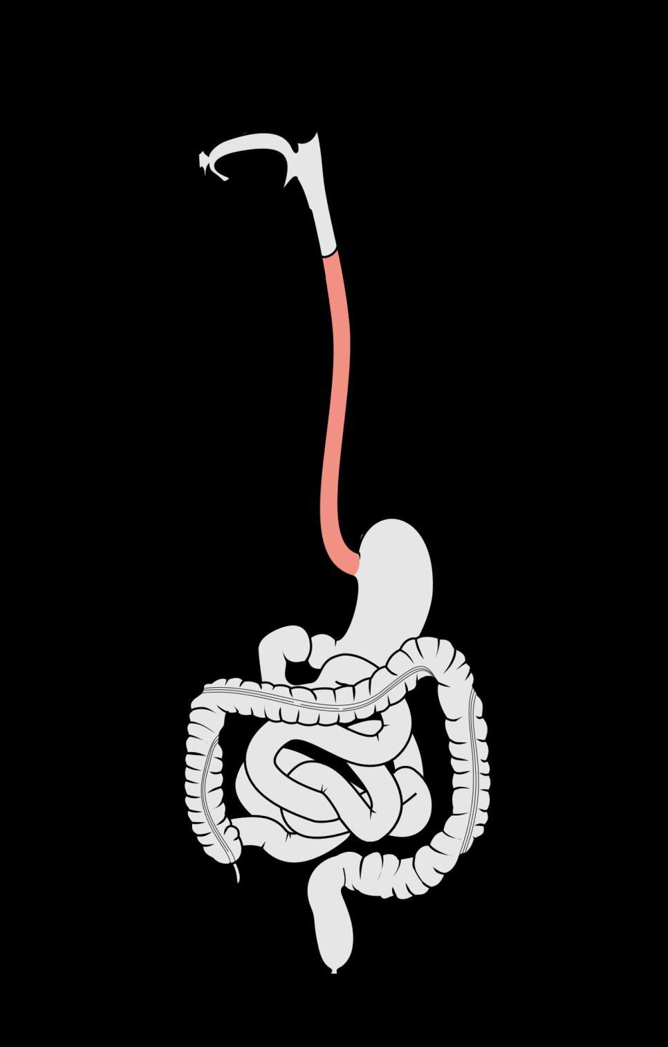 L esofago Tubo muscolare lungo circa 25-30 cm la cui funzione primaria è quella di veicolare il cibo allo stomaco; Sfintere esofageo superiore Passa dietro la trachea ed il cuore,