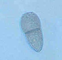 Diffusione dei conidi S. Oleagina ha capacità epifitologiche limitate, poiché i conidi, pur essendo «conidi secchi» (dry spores), vengono disseminati essenzialmente dalla pioggia (water borne).