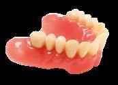 Riposizionamento dei denti nella maschera in silicone 9.