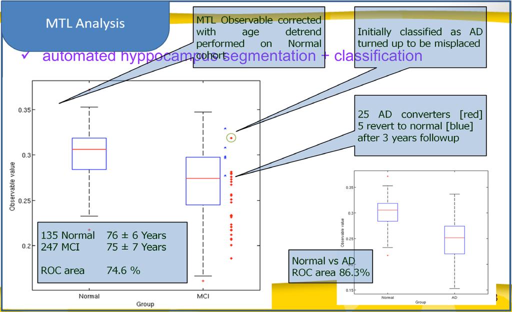 Brain MRI automated hyppocampus