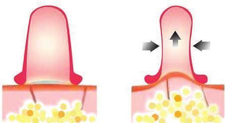 significativi alla microcircolazione.