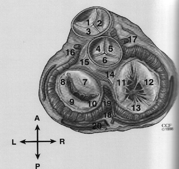 VALVOLA POLMONARE VALVOLA AORTICA VALVOLA TRICUSPIDE