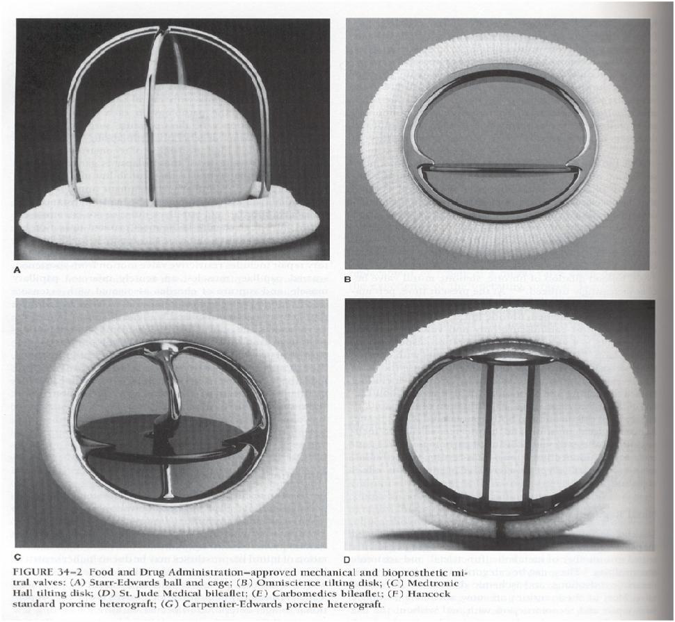Protesi valvolari MECCANICHE