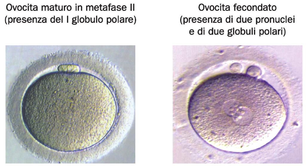 follicolare che assumono l aspetto di una corona radiata. Nel loro insieme costituiscono il c.d. complesso cumulo-ovocita.