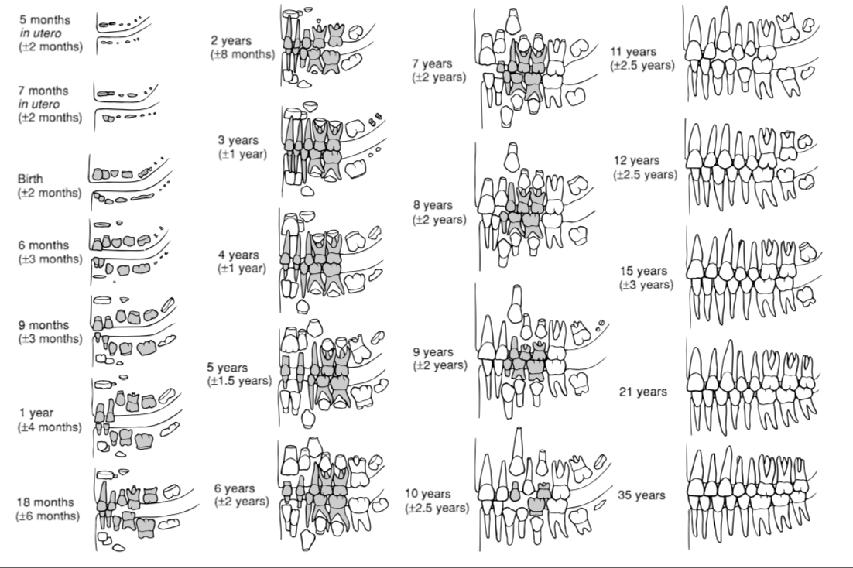 STIMA DELL ETÀ DI MORTE: ERUZIONE DENTARIA Ubelaker, 1989 1 anno: corone decidue complete 4 anno: tutti i