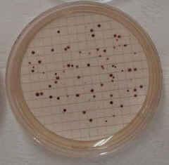 MF MPN Il terreno utilizzato per E. coli, il TBX agar (Triptone Bile X-glucuronide), contiene un complesso cromogeno 5- Br-4-Cl-3-indolil-β-D-glucuronide (X- Gluc). E. coli possiede un enzima, la β-dglucuronidasi, che è in grado di idrolizzare il complesso e consumare lo zucchero.