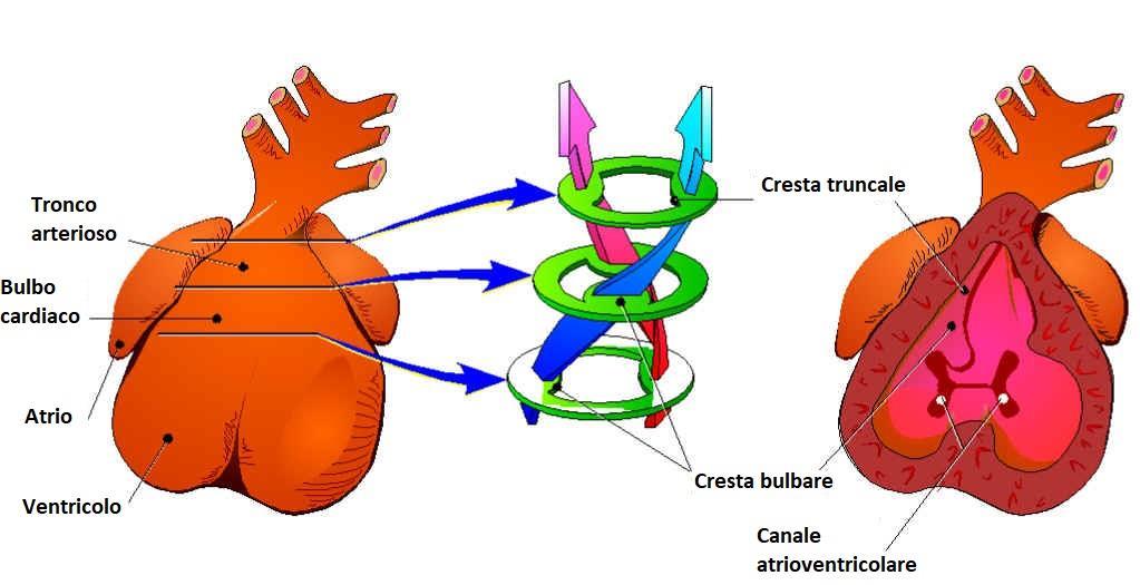 PATOGENESI Il CAT origina da un alterato sviluppo del tronco arterioso che, durante l embriogenesi, invece di dividersi normalmente in due rami, aorta e arteria polmonare, persiste come ramo unico;