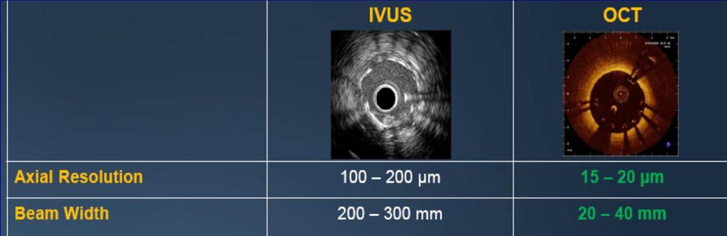 IVUS vs