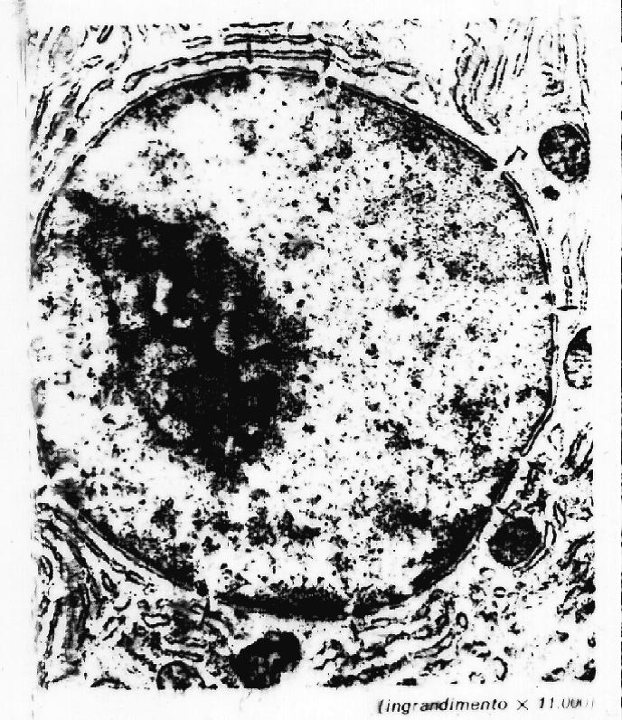 presenti pori MEMBRANA NUCLEARE ESTERNA INTERNA