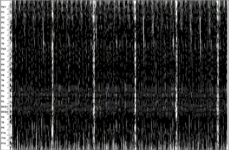 EEG-fMRI processing