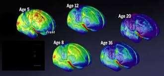 In giallo, verde, arancione: le aree di immaturità cerebrale (0-12/16