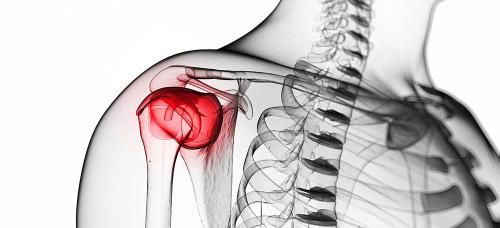 16 CREDITI ECM SHOULDER TENDINOPATHY, IMPINGEMENT, INSTABILITY & SCAPULAR REHABILITATION: WHAT S NEW FROM A SCIENTIFIC & CLINICAL POINT OF VIEW?