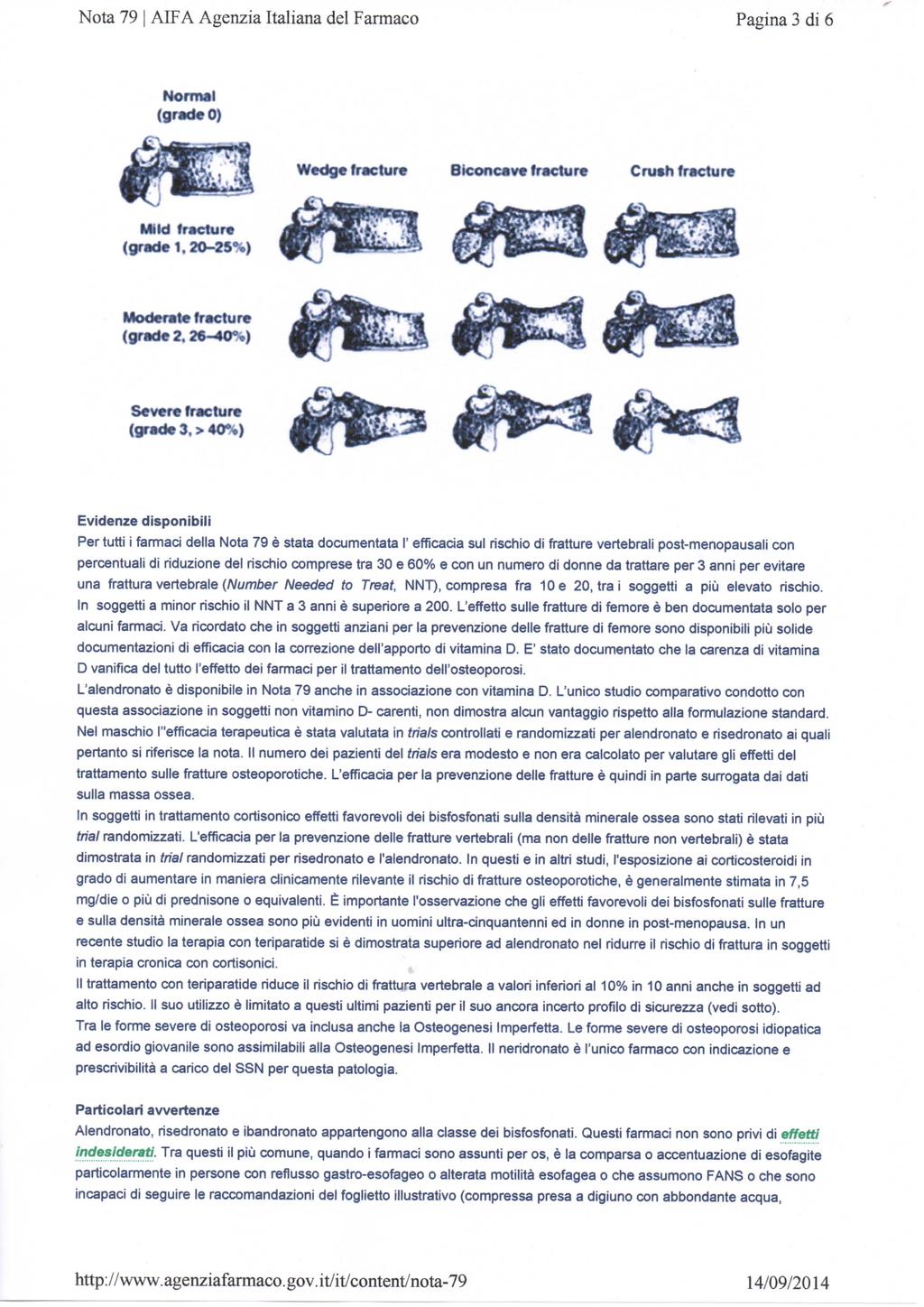 Nota 79 I AIFA Agenzia Italiana del Farmaco Pagina 3 di 6 Normal (gradeo) Wedge fracture Biconcave fracture Crash fracture Mlld fracture (grade 1,20-25%) Moderate fracture (grade2.