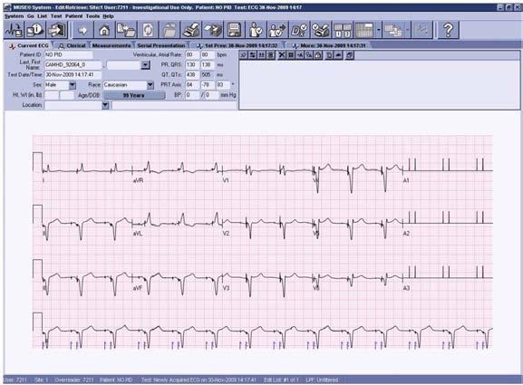 Questa maggiore chiarezza migliora la capacità del sistema di rilevare la presenza degli impulsi del pacemaker, riducendo quindi il numero di ECG ripetuti a causa della