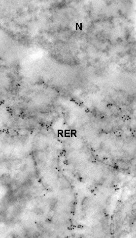 PCR in situ Il DNA o l RNA vengono amplificati