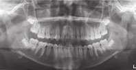 1-1-1) Forma facciale Mesoprosopica (eumorfismo facciale) Simmetria facciale Assenza di asimmetrie evidenti Punto del mento Coincidente con la linea mediana facciale Piano occlusale Normale