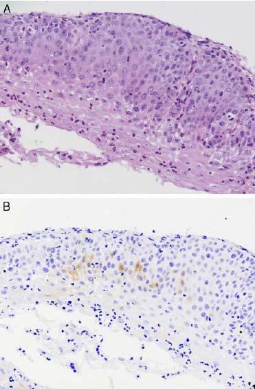 BIOMARCATORI Diagnosi