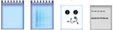 infiammatorio (INTERLEUCHINA-1) WESTERN BLOTTING Tecnica biochimica per quantificare le proteine presenti in un campione biologico