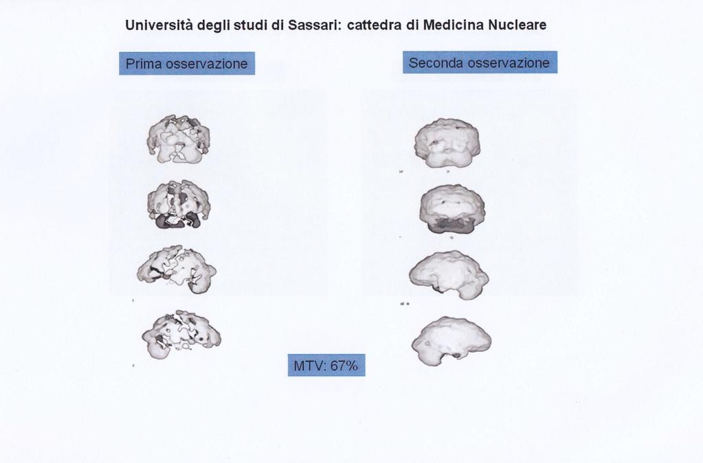 Evidenze strumentali posttrattamento