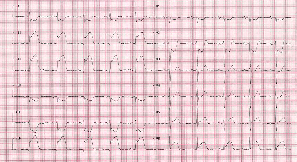 Uomo di 47 anni, dolore epigastrico- retrosternale da 40