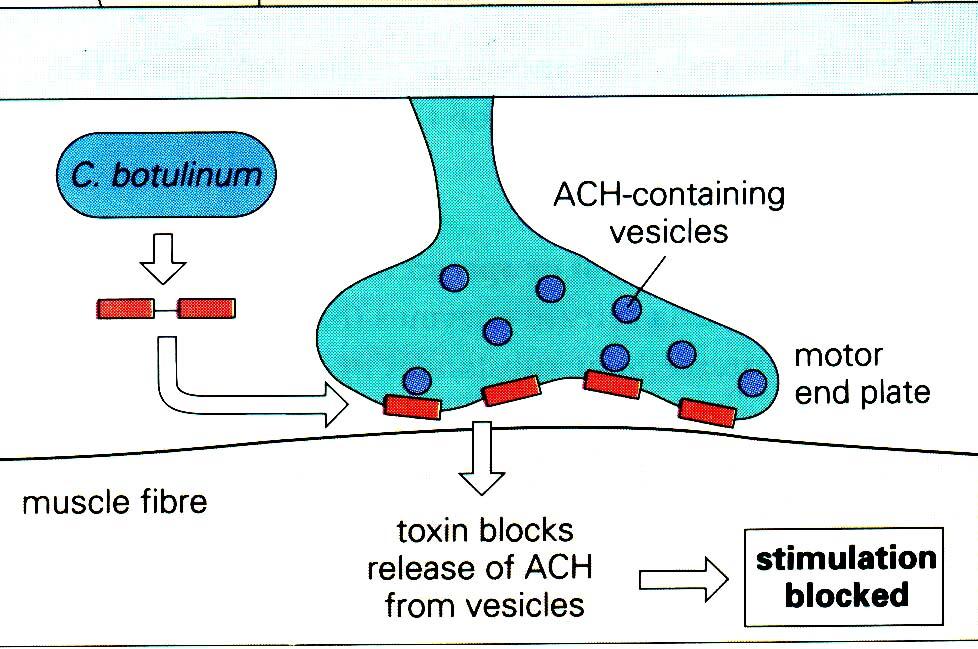 tossina botulinica 7 tipi Ag (A-G)