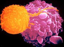 Cellule Natural Killer (NK) Sono dei linfociti particolarmente importanti nella distruzione di cellule tumorali e infettate da virus.