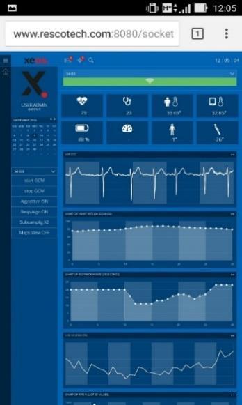 Componenti Software Analisi intelligente ed