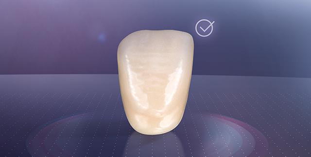 VITA MFT Anterior Per una solida protesi standard con un rapporto qualità-prezzo ottimale Descrizione Denti anteriori Basic in polimero HC per solide protesi standard.