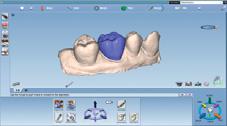 odontoiatria CAD/CAM