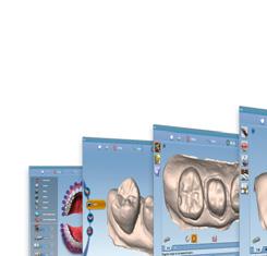 Planmeca PlanCAD Easy è la soluzione ideale per gli studi odontoiatrici efficienti.