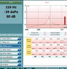 Una combinazione semplice e affidabile AA222 è la più completa combinazione di analizzatore dell orecchio medio con funzionalità diagnostiche e cliniche & audiometro diagnostico Timpanogramma e test