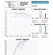 Stampa attraverso il software Diagnostic Suite Scegli il tuo linguaggio La visualizzazione delle lingue di AA222 può essere selezionata a seconda delle esigenze: cinese, ceco, inglese,