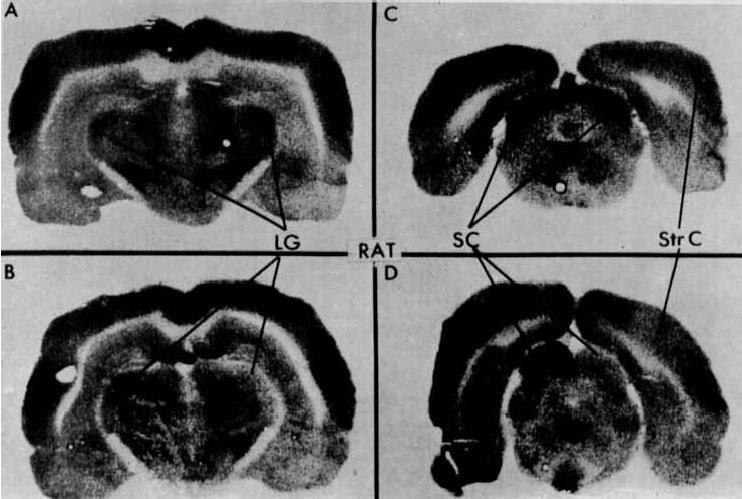 The Study of Synaptic Function with Molecular Neuroimaging Ma Luis andò oltre Se conoscere come funziona il cervello significa fotografare il funzionamento della sinapsi, se il funzionamento della