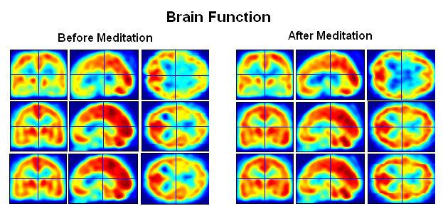 The Study of Functional Brain with Molecular