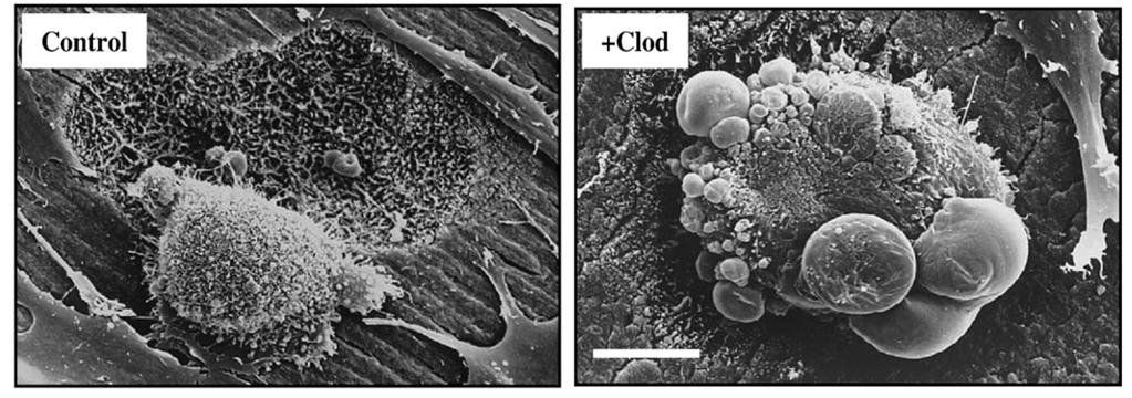 EﬀeS del clodronato sulla stru>ura degli osteoclas# Distruzione del ruffled border (adesione tra osteoclasta e