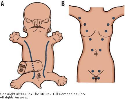 (3) Lo sviluppo della mammella deriva dalla differenziazione dell epidermide che avviene durante il secondo mese di gestazione e determina la formazione delle creste mammarie, che si estendono dall